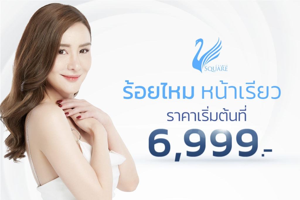 โปรโมชั่น-ร้อยไหมหน้าเรียวราคา